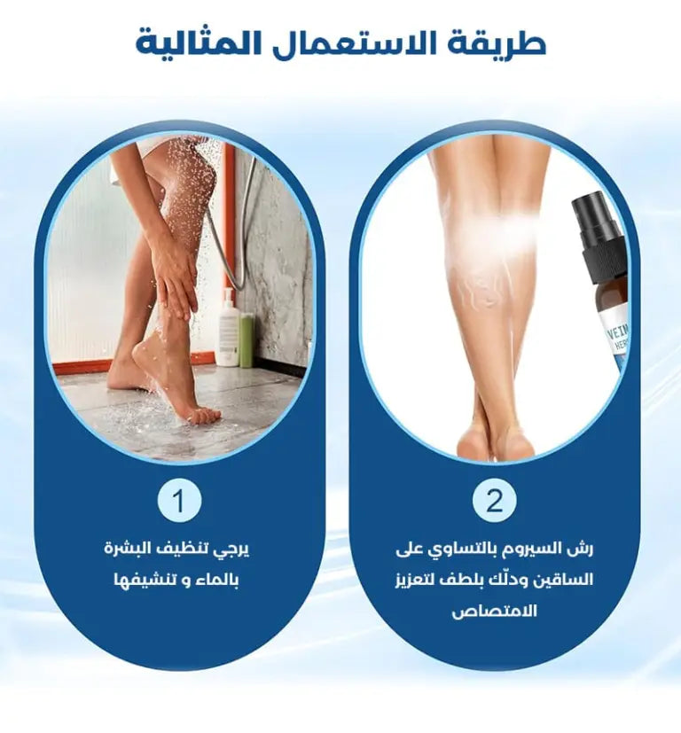 رذاذ علاج الدوالي الوريدية