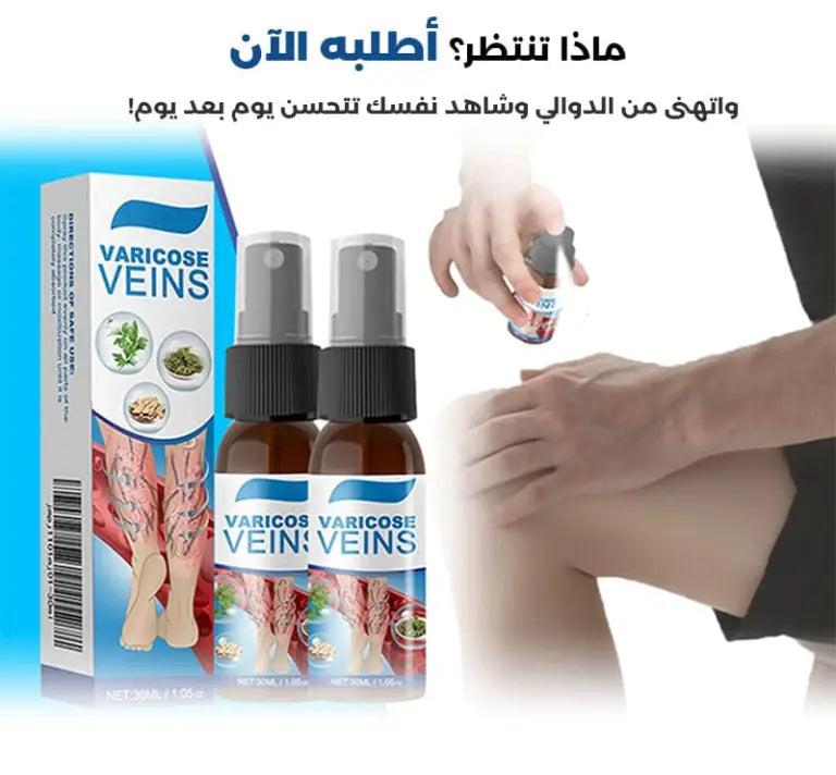 رذاذ علاج الدوالي الوريدية